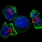 Jean Solomidès et les péroxydases : Le remède contre le cancer supprimé ? Jean Solomidès et les péroxydases Le remède contre le cancer supprimé